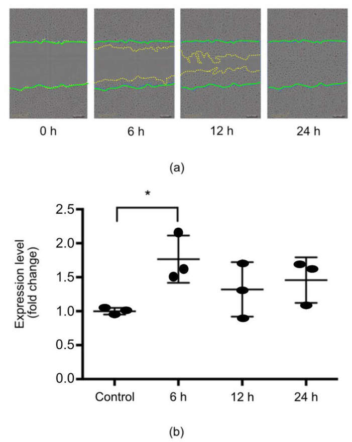 Human urothelial cells (HUCs) upregulated miR-132 expression after in vitro scratch wounding.