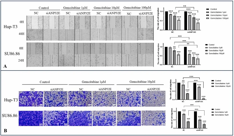 (A) Wound healing and (B) Transwell migration assays were performed to assess changes in migratory activity of pancreatic cancer cells after down-regulation of ANP32E with or without gemcitabine treatment.