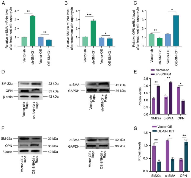Changes in VSMCs phenotype following silencing and overexpression of SNHG1.