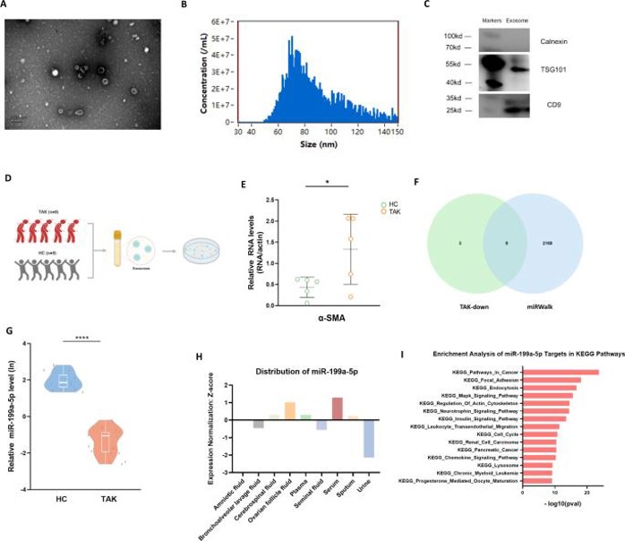 The serum exosomes from TAK patients contributed to phenotypic modulation of VSMC.