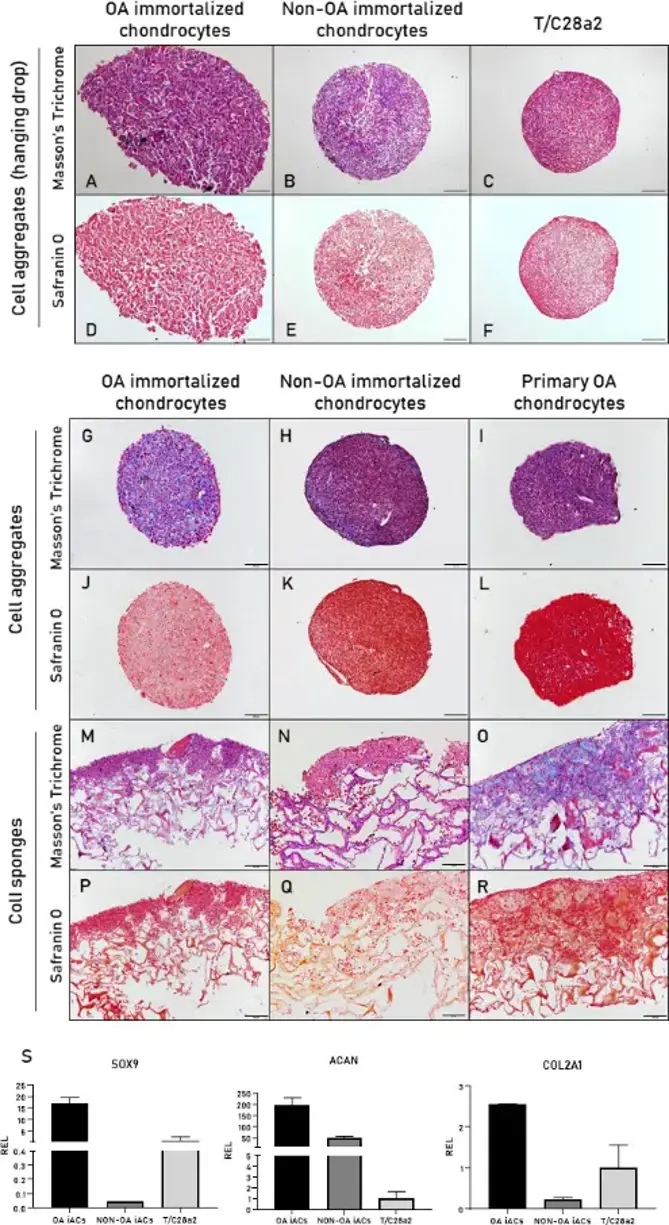 a) to f) Masson's trichrome and Safranin O staining after tridimensional culture in chondrogenic medium: osteoarthritic (OA) and non-OA immortalized chondrocytes and T/C28a2 cell aggregates, g) to l) OA and non-OA immortalized chondrocytes and primary OA chondrocyte micropellets, and m) to r) the same cells seeded on collagen sponges. s) Relative expression levels (RELs) of the characteristic chondrogenic markers type 2 collagen alpha chain 1 (COL2A1), aggrecan (ACAN), and sex-determining region Y (SRY)-Box Transcription Factor 9 (SOX9), analyzed on cell aggregates.