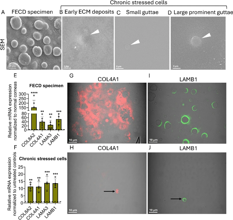 Ultrastructural and molecular characterization of guttae in FECD patient specimens and in vitro models.