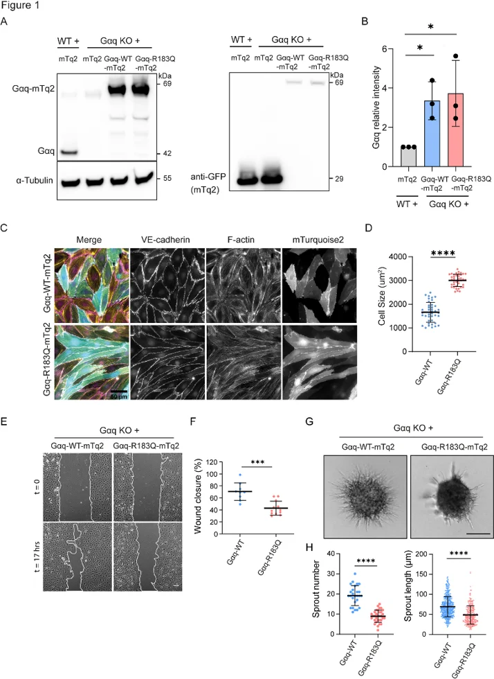 Impact of Gαq-R183Q mutation on endothelial cell morphology and function.