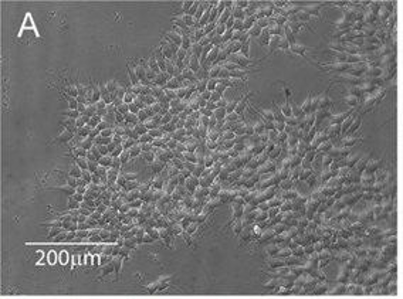 Bright-field micrographs showing LUHMES neuronal cultures.