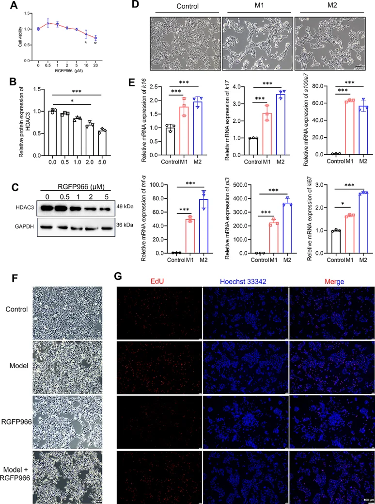 HDAC3 inhibition suppresses HaCaT cells proliferation in psoriasis-like cell models.