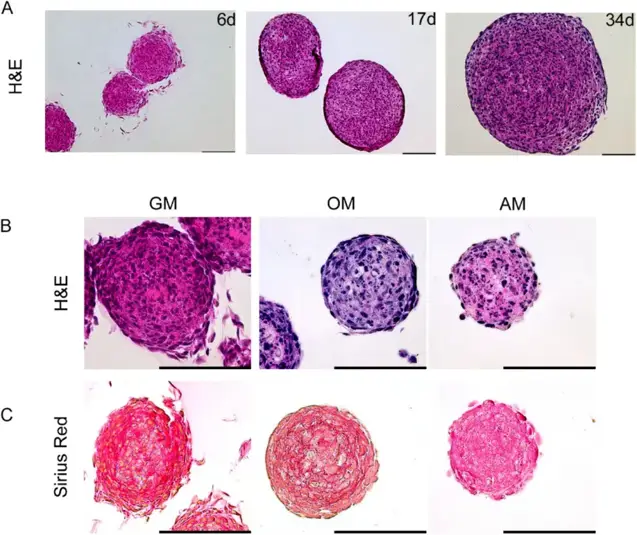hFOB spheroid development under proliferative, osteo- and adipo-inductive conditions.