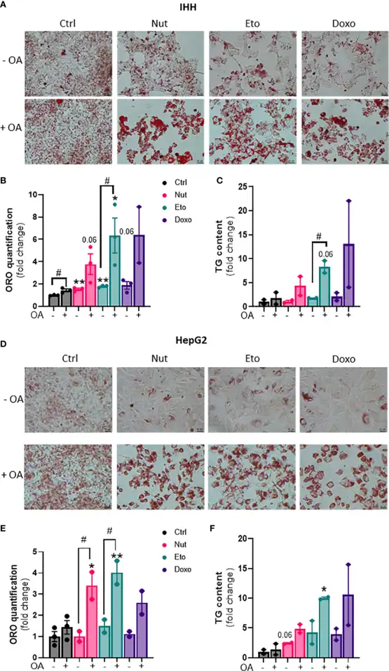 Cellular senescence increases steatosis in human hepatocytes HepG2 and IHH.