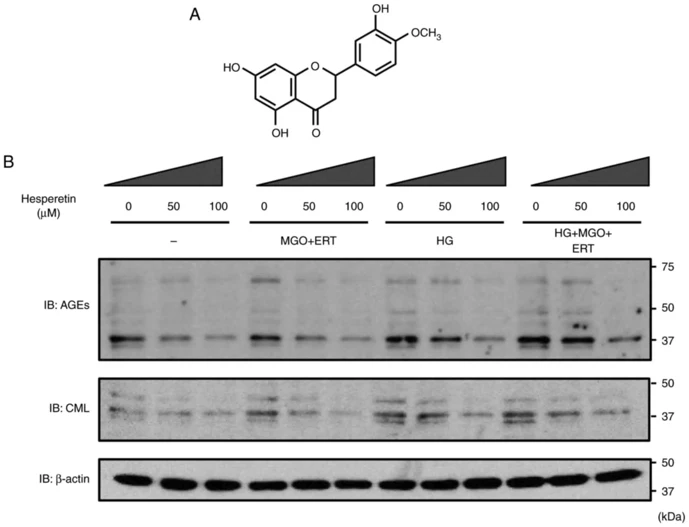 Effect of Hst treatment on AGE modifications of lens epithelial cell lines.