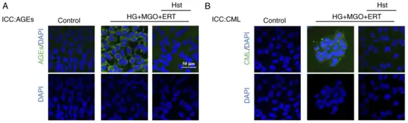 Effect of Hst treatment on AGE and CML formations in lens epithelial cell lines.