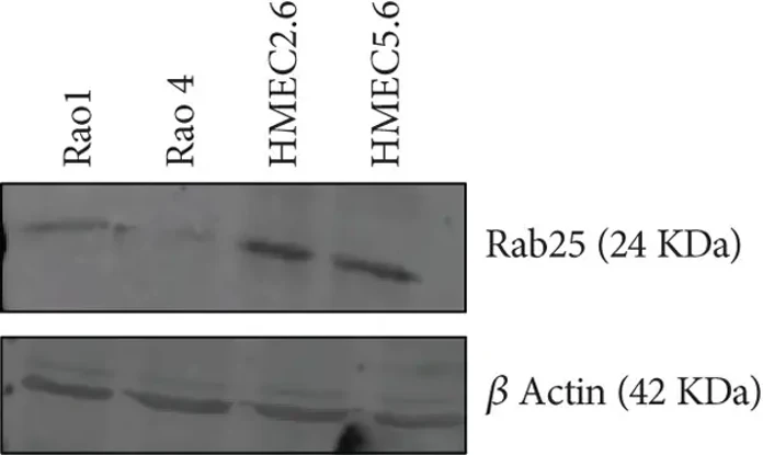 Reconfirmation of RAB25 downregulation in HMEC lines.