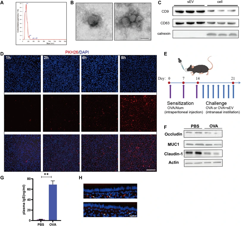 MSC-sEV reduced nasal inflammation and mucosa injury in a mouse model of AR.