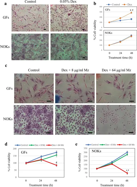 Effect of drug treatment (Dex and/or Mz) on the viability of GFs and NOKs.