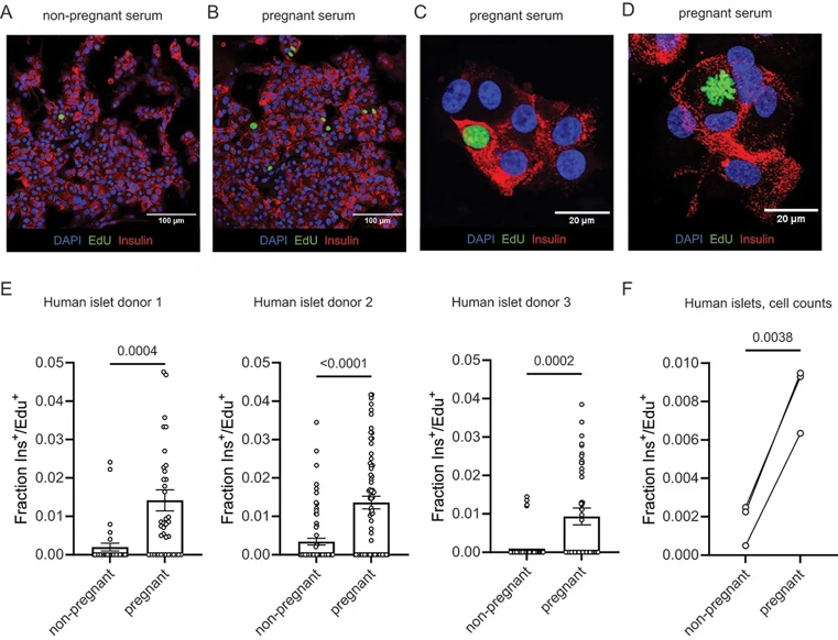 Pregnant human serum increases proliferation in primary human beta cells.