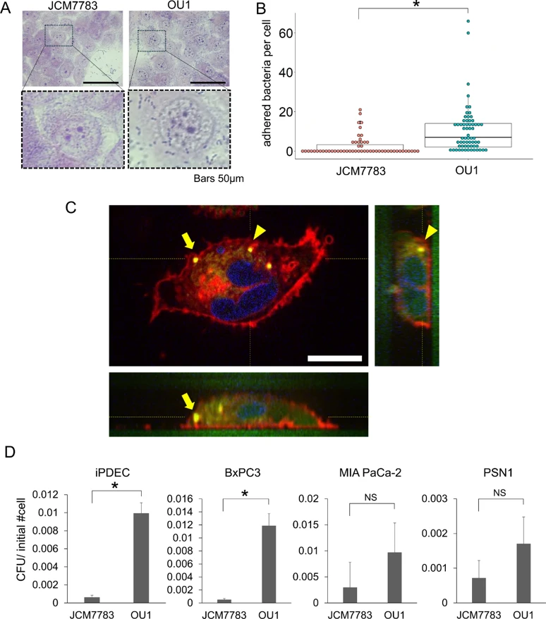 E. faecalis adheres to pancreatic ductal epithelial cells.