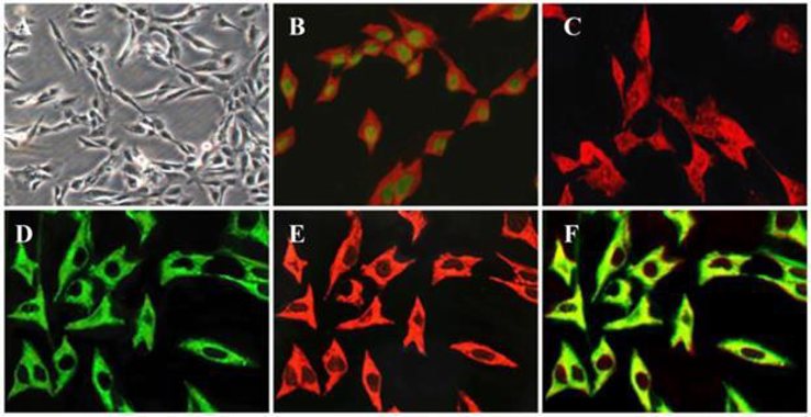 Key characteristics of the immortalized human pancreatic stellate cell line