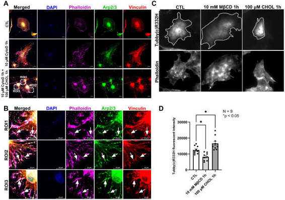 IF to check cholesterol levels on actin-binding protein Arp2/3 distribution in HTM cells and TIRF imaging of PIP2 dynamic changes on the cell membrane.