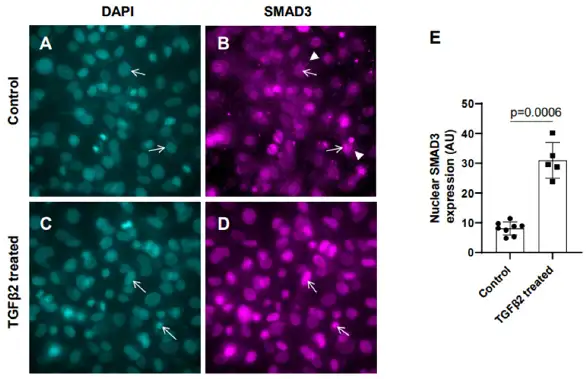 TGFβ2 induces nuclear translocation of SMAD3 in cushion mesenchymal cells.