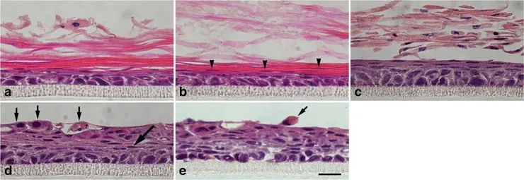 Serum inhibition of keratinization in 3D cultures of COCA.