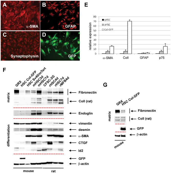 Characterization of immortalized Col-GFP stellate cells.