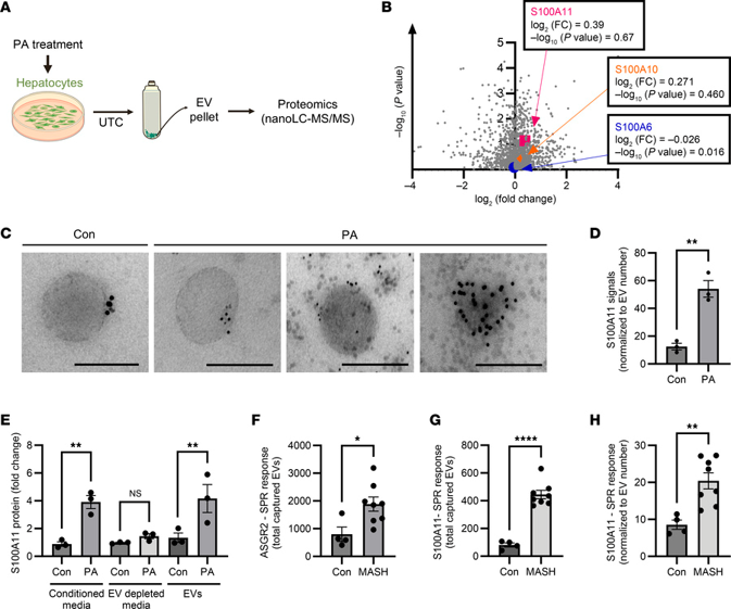 S100A11 is enriched in hepatic EVs