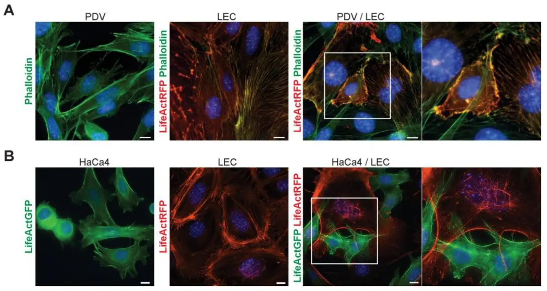 LECs and cancer cells exhibit morphology changes and actin reorganization when co–cultured (Cazzola, Anna, et al., 2023).