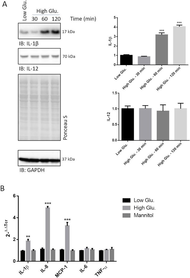 The transcription of pro-inflammatory cytokines in rMC1 cells is quickly induced by high glucose.