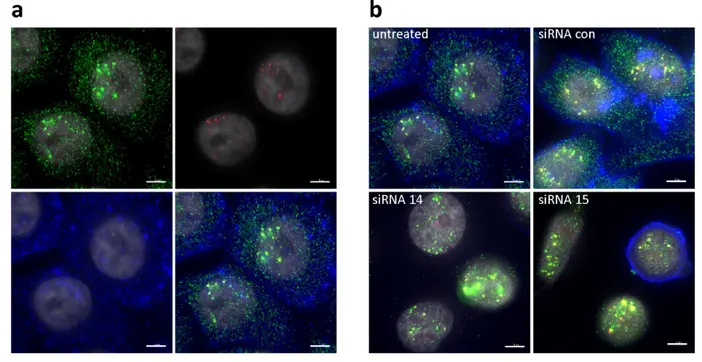 Analysis of HER2 mRNA subcellular location by immunoFISH.