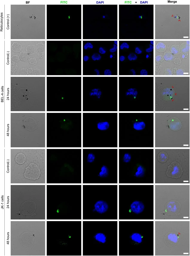 P. vivax invades BEL-A and JK-1 cells