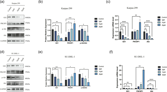 The Gli inhibitor GANT61 disrupted the PI3K/Akt signaling pathway in ALK + ALCL cell lines.