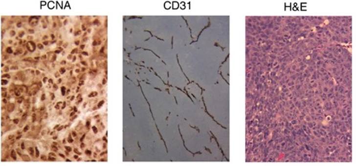  Immunohistochemical staining H&E, CD31, and PCNA of KM12L4 cell line.