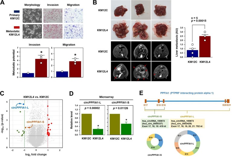 circPPFIA1 is downregulated in liver metastatic colorectal cancer.
