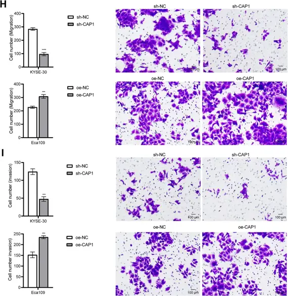 (H) ESCA cell migration. (I) ESCA cell invasion.
