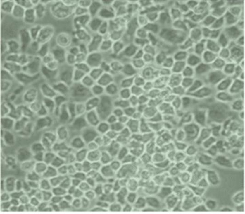 Morphology of cells grown in RMPI 1640 medium supplemented with 10% FBS.