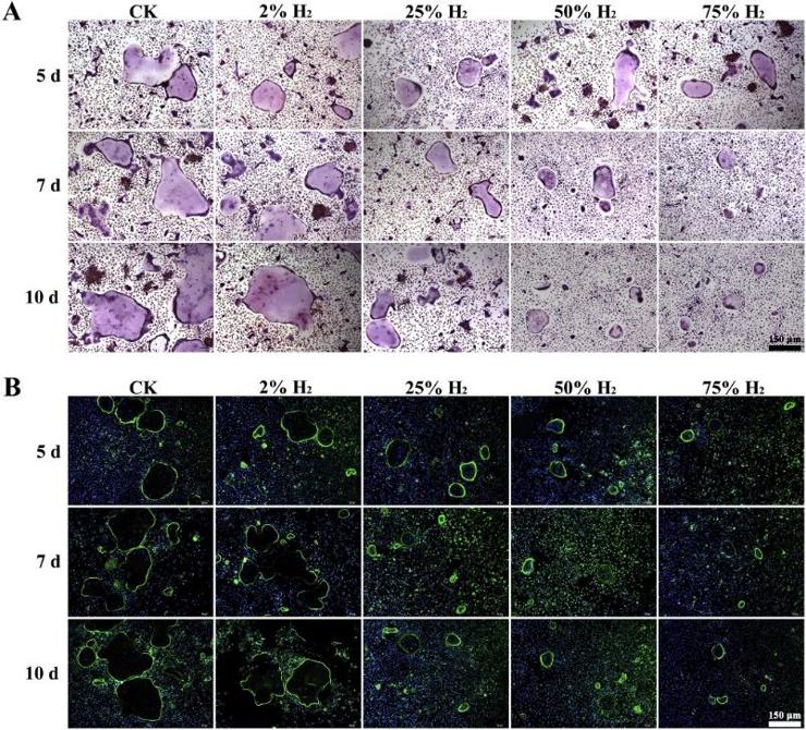 H2 inhibits the osteoclastogenesis of BMMCs.