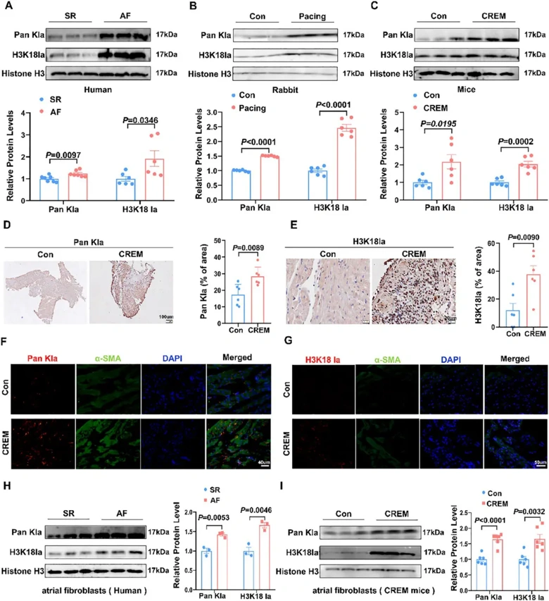 Enhanced Glycolysis Promotes Cardiac Fibroblasts Histone Lactylation in Atrium.