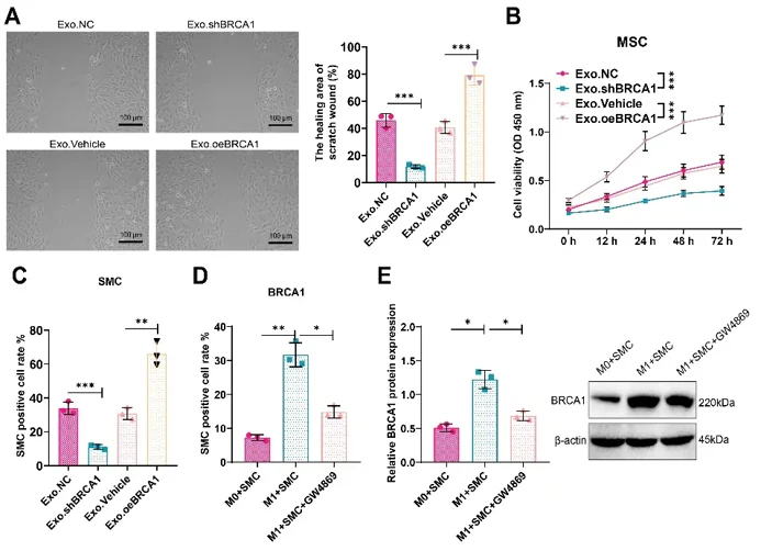 Macrophage-Derived exo facilitate SMC cell proliferation and migration via BRCA1 delivery.