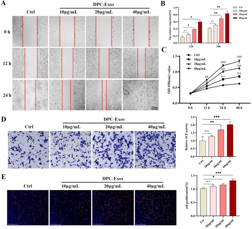 DPC-Exos promotes fibroblast proliferation and migration in a concentration-dependent manner.