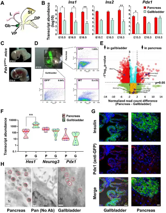 Mouse gallbladder and pancreas development.