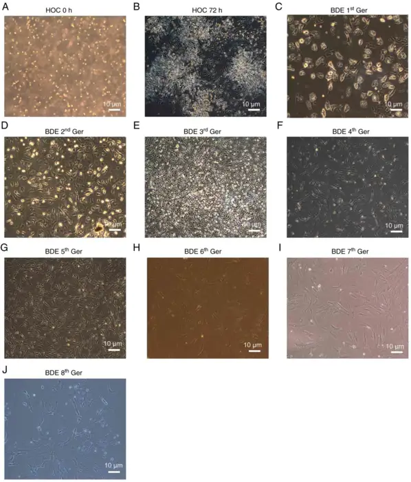 HOCs morphological features in the original generation and differentiation into BDEs with 10 µg EGF + 5 µg stem cell growth factor + 5 µg leukemia inhibitory factor.