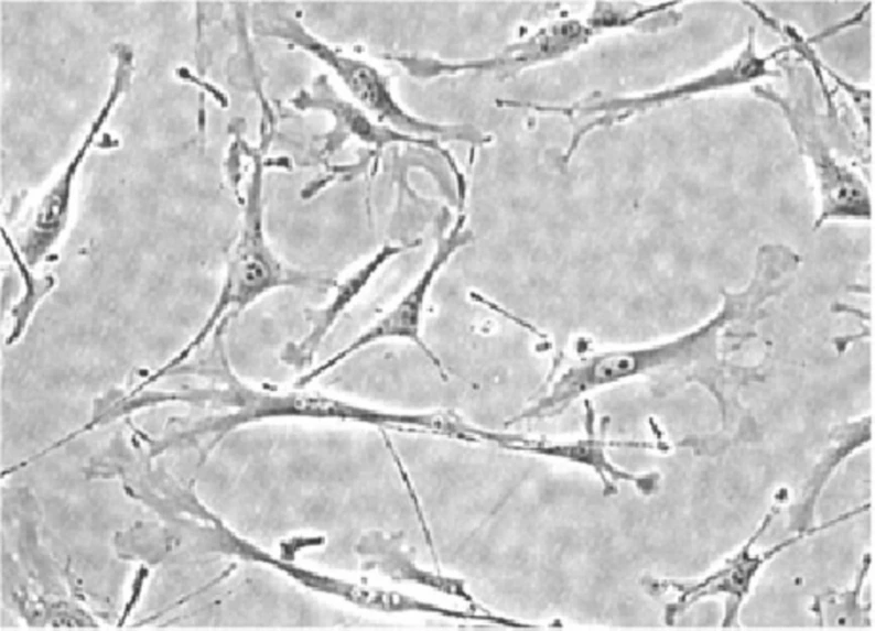 Mouse lung fibroblasts.