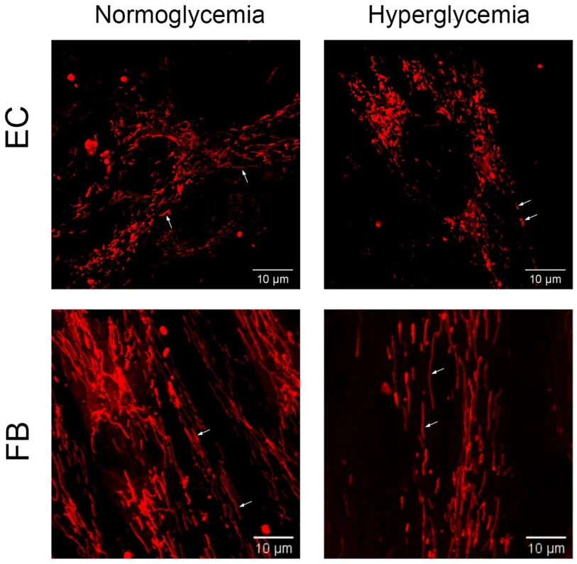 Representative images showing the morphology of MitoTracker Red-labeled mitochondria in primary human dermal fibroblasts (FB) and mouse lung microvascular endothelial cells (EC) cultured under control conditions (normoglycemia, 5.5 mM D-glucose) and 36 h hyperglycemia (30 mM D-glucose).