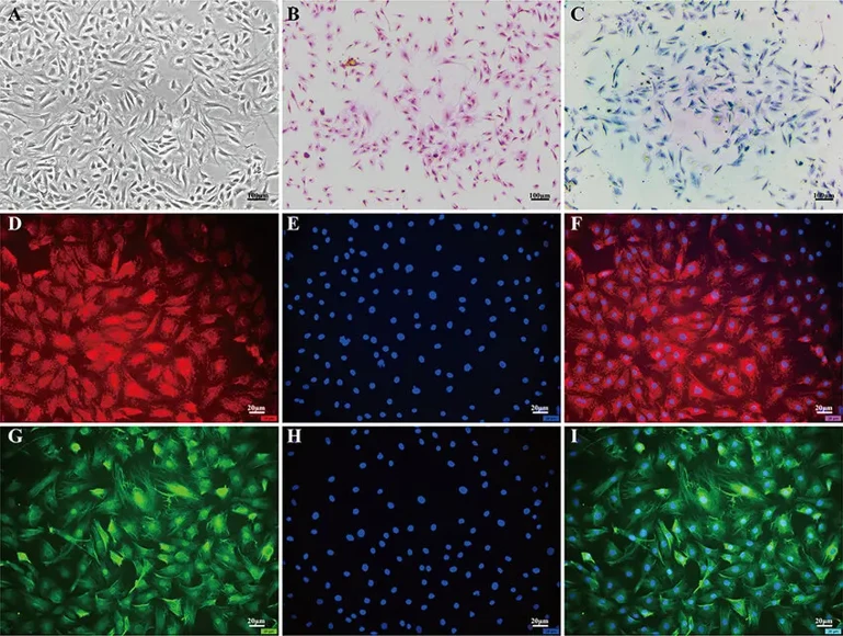 Morphological examination of NPCs. (A) Morphology of nucleus pulposus cells (NPCs) observed under an optical inverted microscope. (B) Hematoxylin and eosin staining revealed blue nuclei and pink cytoplasm in NPCs. (C) Toluidine blue staining showed dark blue nuclei and light blue cytoplasm in NPCs. (D-F) Collagen II immunofluorescence staining exhibited red fluorescence in NPCs. (G-I) Aggrecan immunofluorescence staining displayed green fluorescence in NPCs.