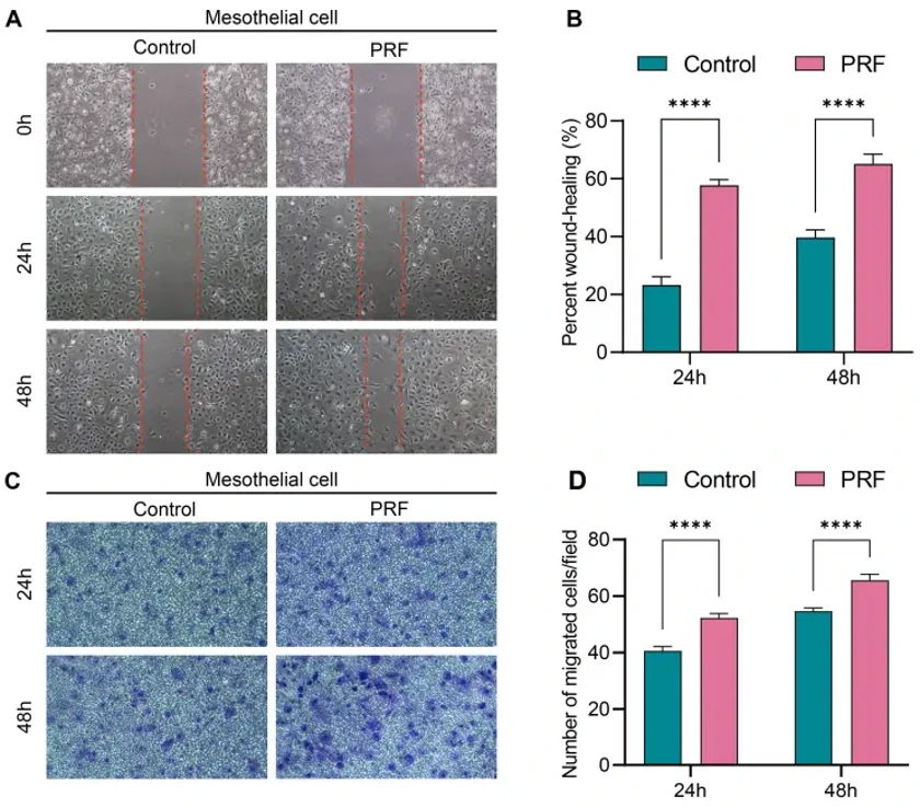 The effect of PRF on the migration ability of mesothelial cells.