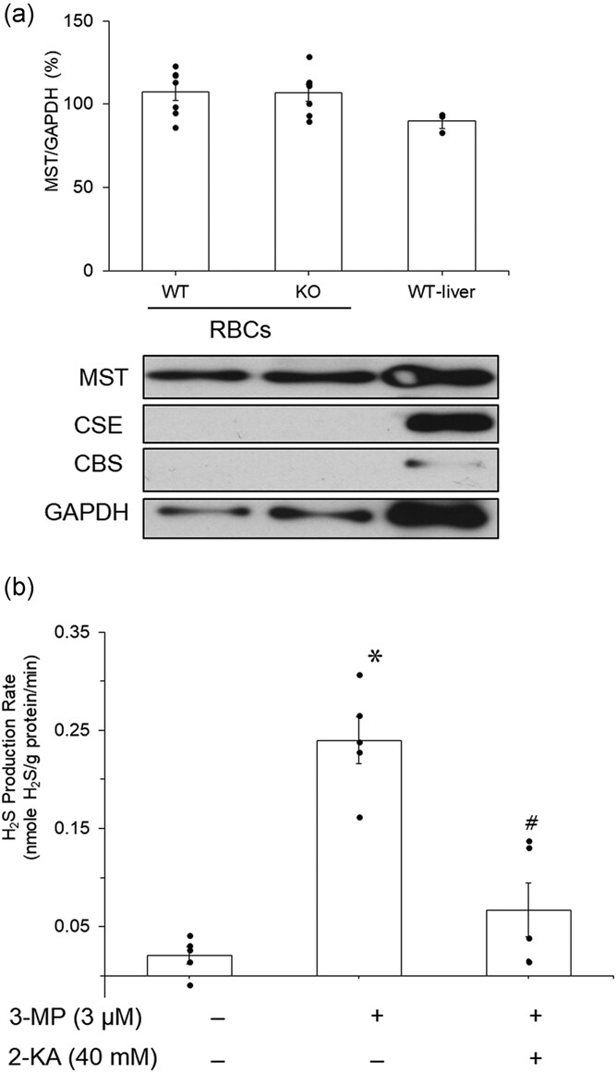H2S synthesis in mouse red blood cells (RBCs).