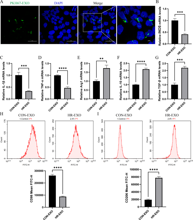Exosomes derived from ferroptotic RTECs promote M2 macrophage polarization.