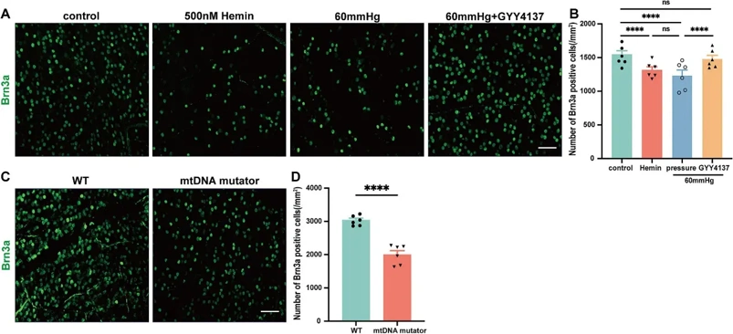 Iron overload, pressure, mitochondrial mutations, and H2S protection on RGCs survival.