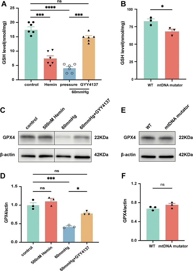 Pressure-induced ferroptosis in retina: H2S restores antioxidant defense and Gpx4.