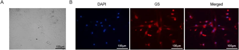 (A) Observation of Müller cell morphology under a phase contrast microscope. (B) Fluorescence staining for Müller cell-specific enzyme glutamine synthetase.