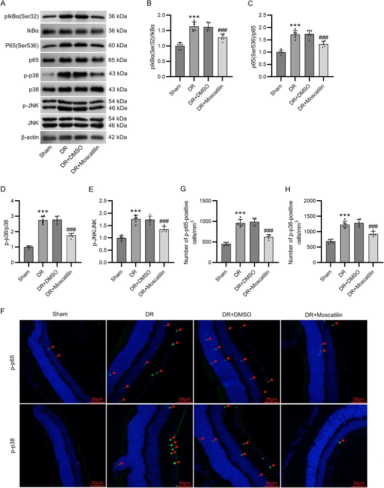 (A-E) Western blotting of p-IkBα, IkBα, p-p65, p65, p-p38, p38, JNK, and p-JNK protein levels in the mouse retina. (F-H) Assessment of p-p65 and p-p38 expression in the mouse retina through immunohistochemical staining.