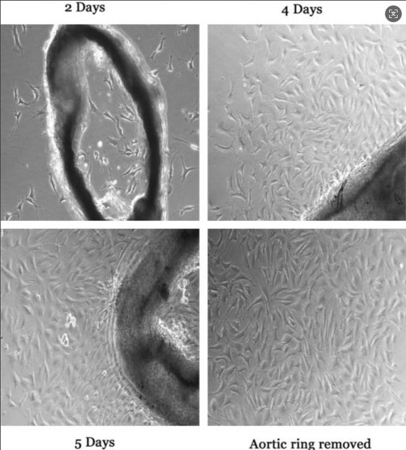 Isolation and culture of mouse aortic endothelial cells (MAEC).